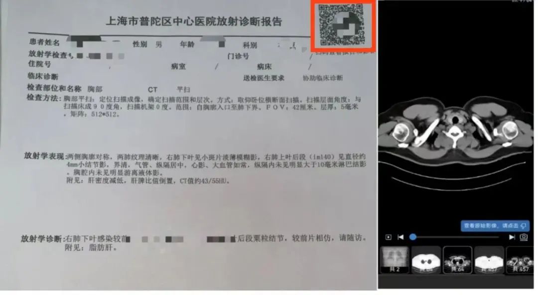 取片机怎么用医路畅通｜取片不用跑，云胶片“码”上可见！普陀区中心医院进入“云胶片”时代_https://www.jmylbn.com_新闻资讯_第5张