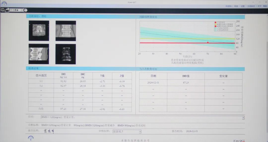 一次扫描，多项共查，QCT技术了解下→
