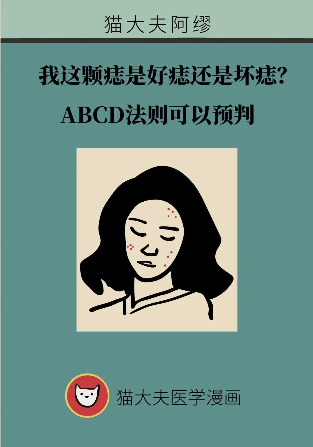 这颗痣是好痣还是坏痣？ABCD法则可以预判