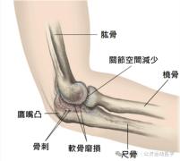 怎么调节cpm康复机康复——肘腕｜肘关节清理和松解术术后康复程序_https://www.jmylbn.com_新闻资讯_第1张