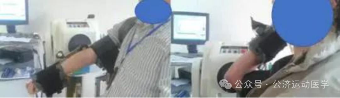 怎么调节cpm康复机康复——肘腕｜肘关节清理和松解术术后康复程序_https://www.jmylbn.com_新闻资讯_第4张