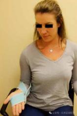 怎么调节cpm康复机康复——肘腕｜肘关节清理和松解术术后康复程序_https://www.jmylbn.com_新闻资讯_第10张