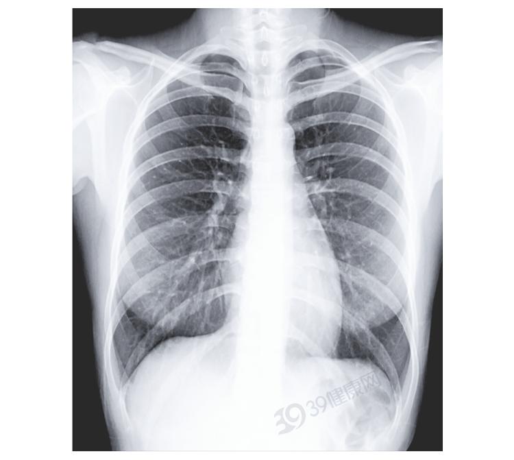 太行ct怎么样做一次CT，对人体的伤害有多大？CT做多了会致癌？_https://www.jmylbn.com_新闻资讯_第12张