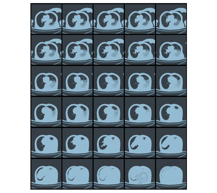 太行ct怎么样做一次CT，对人体的伤害有多大？CT做多了会致癌？_https://www.jmylbn.com_新闻资讯_第14张