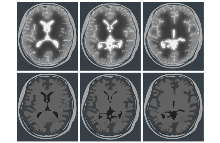 太行ct怎么样做一次CT，对人体的伤害有多大？CT做多了会致癌？_https://www.jmylbn.com_新闻资讯_第15张