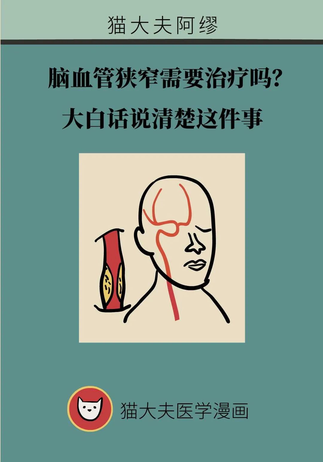 脑血管狭窄需要治疗吗？大白话说清楚这件事