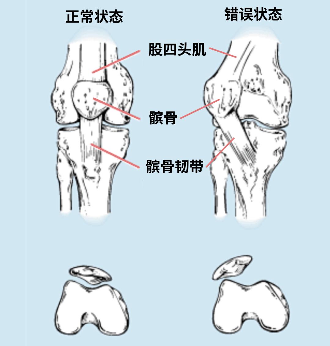 :马自达6老款多少钱一辆-长期不运动的人，千万不要突然开始啊