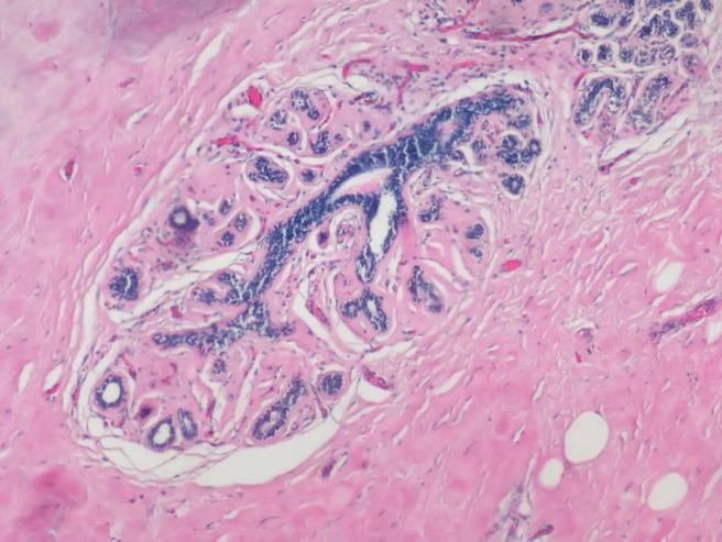 FISH怎么诊断CTC【企业资讯】明美显微成像解决方案：免疫细胞疗法与癌症研究的得力助手_https://www.jmylbn.com_新闻资讯_第1张
