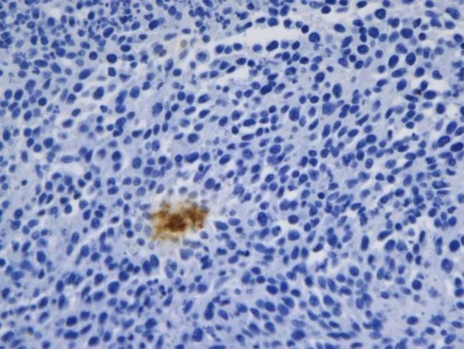 FISH怎么诊断CTC【企业资讯】明美显微成像解决方案：免疫细胞疗法与癌症研究的得力助手_https://www.jmylbn.com_新闻资讯_第2张