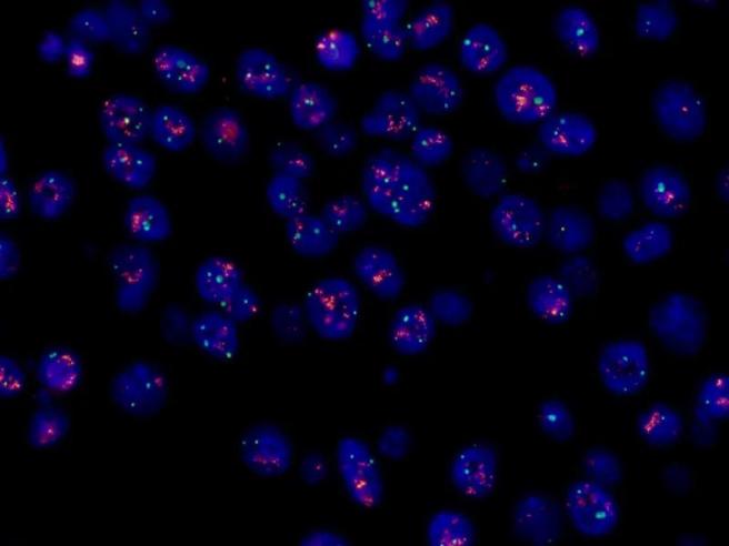 FISH怎么诊断CTC【企业资讯】明美显微成像解决方案：免疫细胞疗法与癌症研究的得力助手_https://www.jmylbn.com_新闻资讯_第3张