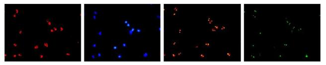 FISH怎么诊断CTC【企业资讯】明美显微成像解决方案：免疫细胞疗法与癌症研究的得力助手_https://www.jmylbn.com_新闻资讯_第4张