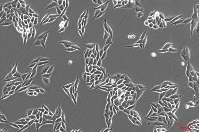 FISH怎么诊断CTC【企业资讯】明美显微成像解决方案：免疫细胞疗法与癌症研究的得力助手_https://www.jmylbn.com_新闻资讯_第5张