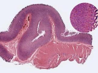 FISH怎么诊断CTC【企业资讯】明美显微成像解决方案：免疫细胞疗法与癌症研究的得力助手_https://www.jmylbn.com_新闻资讯_第7张