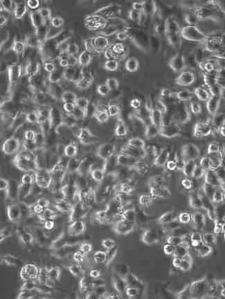 FISH怎么诊断CTC【企业资讯】明美显微成像解决方案：免疫细胞疗法与癌症研究的得力助手_https://www.jmylbn.com_新闻资讯_第9张