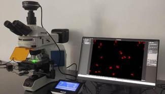 FISH怎么诊断CTC【企业资讯】明美显微成像解决方案：免疫细胞疗法与癌症研究的得力助手_https://www.jmylbn.com_新闻资讯_第10张