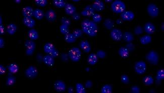 FISH怎么诊断CTC【企业资讯】明美显微成像解决方案：免疫细胞疗法与癌症研究的得力助手_https://www.jmylbn.com_新闻资讯_第11张