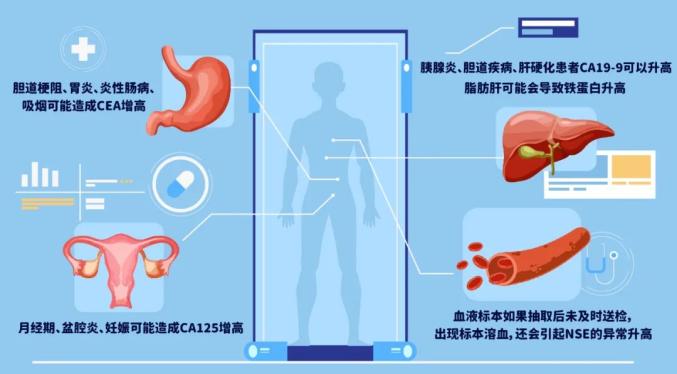 体检肿瘤标志物升高，是不是得癌症了？