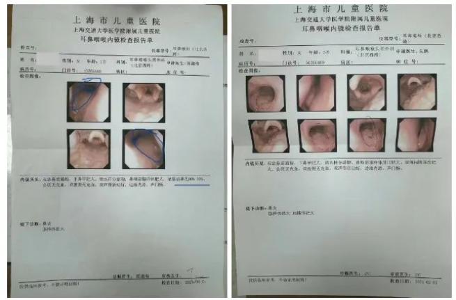 “小儿鼻病”海派儿推来守护—长宁区江苏街道社区卫生服务中心海派儿科推拿治疗小儿鼻病丨上海市中医特色…
