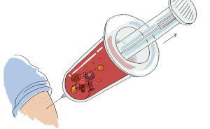 【問答】傳說大魚大肉以后，抽血抽出一管“油”，這可能嗎？