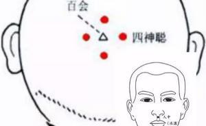 萬米高空牙簽救人，穴位急救其實你也能學(xué)