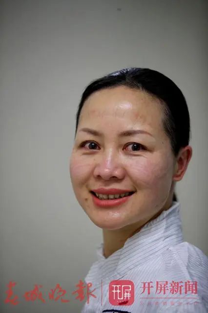 黄燕,31岁,曲靖市妇幼保健院."无穷的力量都在逆行中".