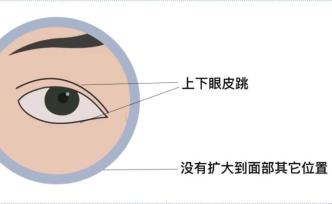 關節響、打嗝、眼皮跳，這些小毛病是疾病的先兆嗎？