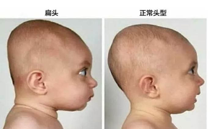 1岁宝宝变脑瘫，父母5个惯常动作会损害宝宝大脑发育