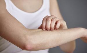 院内神药丨这家医院皮肤科30种自制神器，连医生都自留用