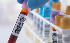 辟謠｜一日三餐全靠外賣，血漿變成“豬油色”，這是真的嗎？