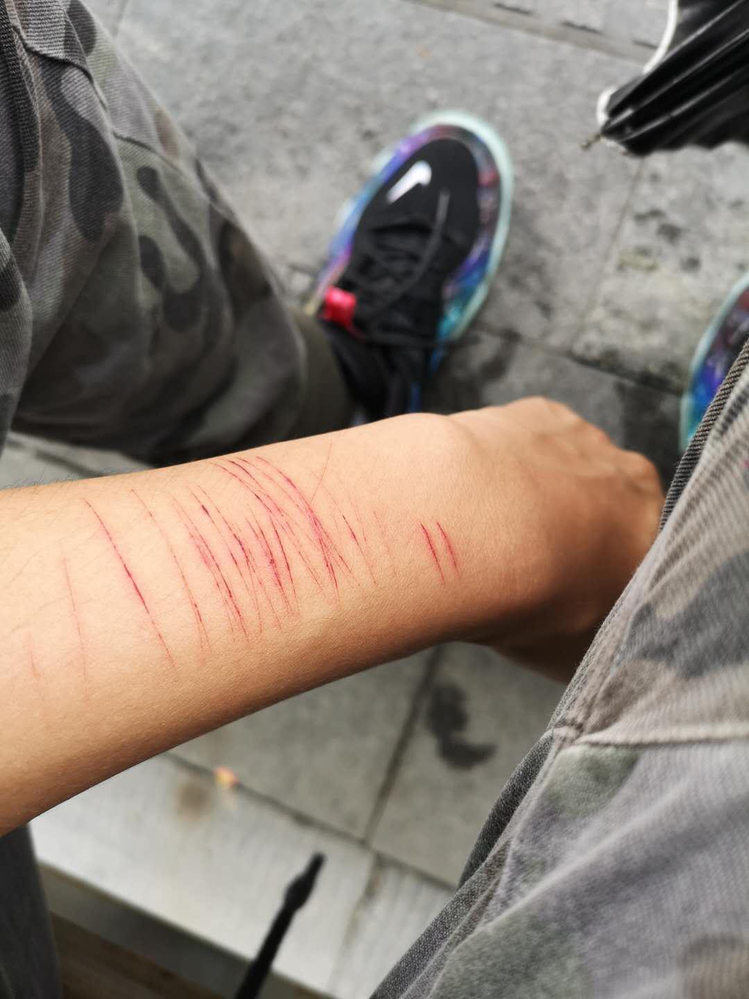 小伙儿炒鞋被人"割韭菜"骗了135万,还不上钱把自己手臂划得一道一道的