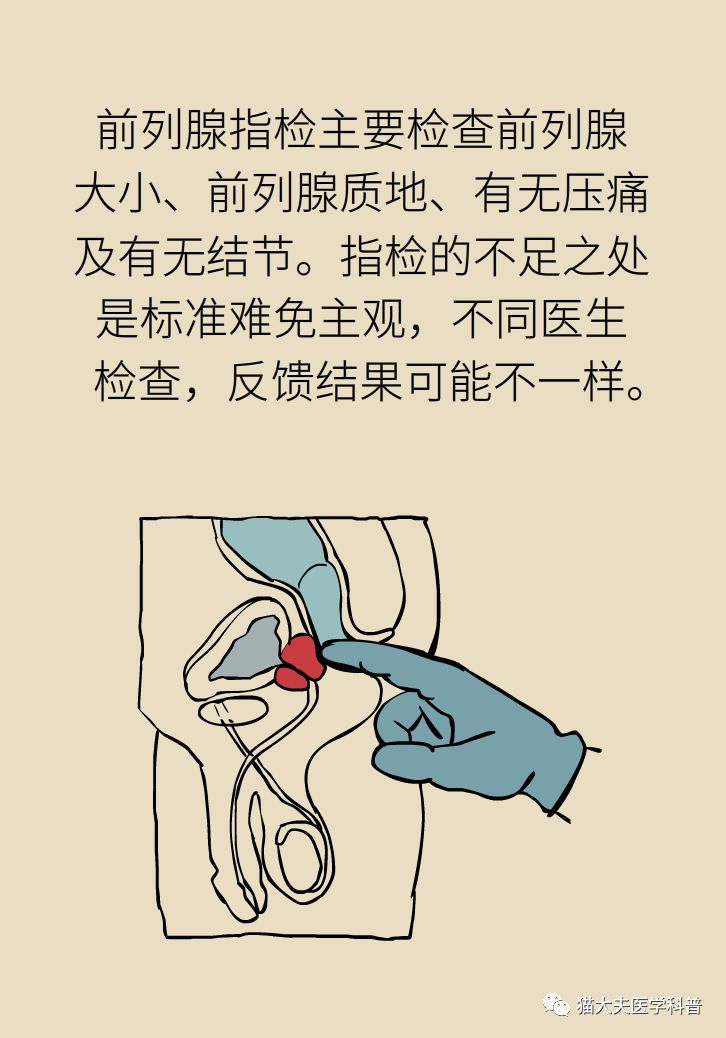 前列腺肥大了还能缩小吗?