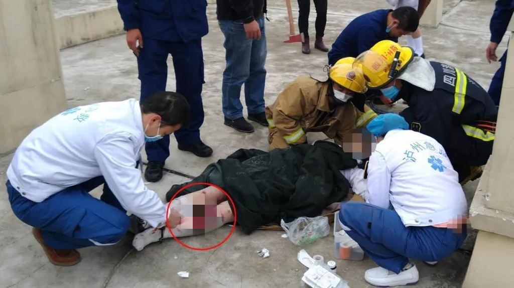 17岁女孩烟道卡住救援_泸县女孩烟道救援_四川女孩太瘦脚卡在下水道