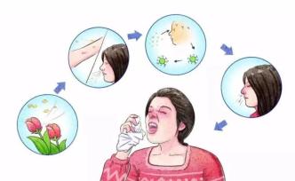 一把鼻涕一把泪？过敏性鼻炎如何才能标本兼治？