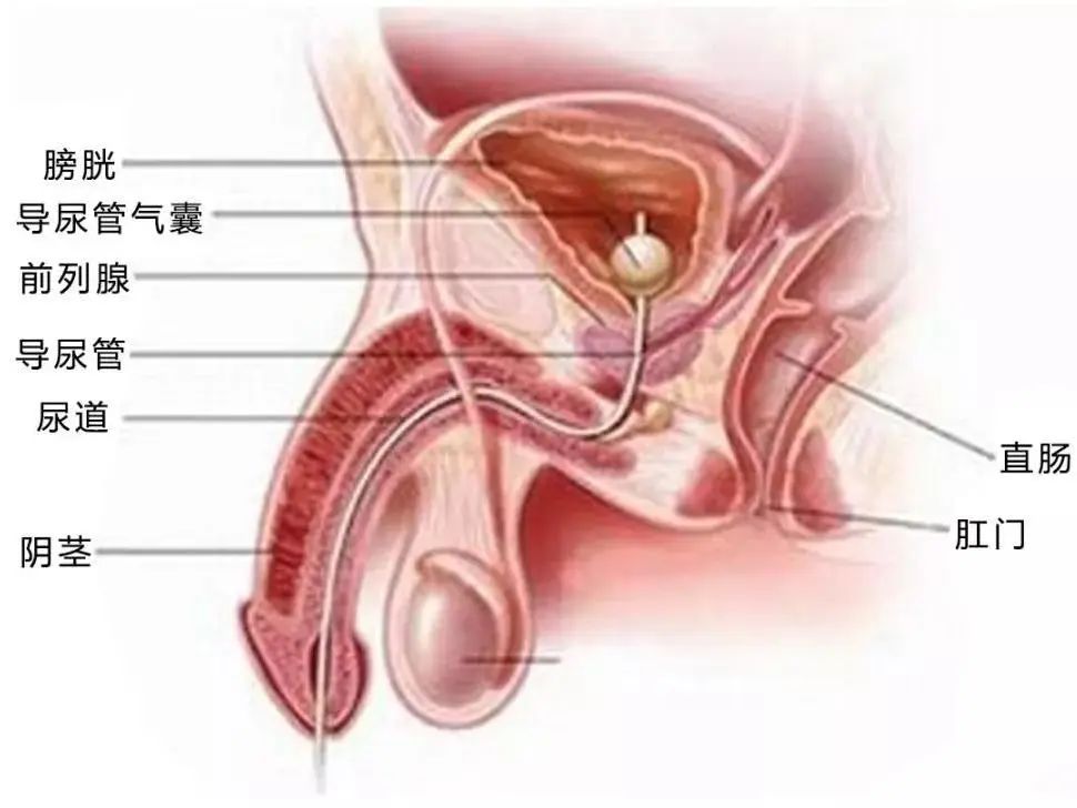 膀胱的准确位置图图片