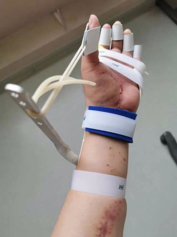 被砍医生陶勇出院不把自己埋在仇恨中不代表我可以宽恕他