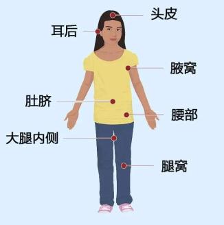 检查的重点部位为头皮,耳后,腋窝,腰部,腹股沟,大腿内侧及腿窝等部位