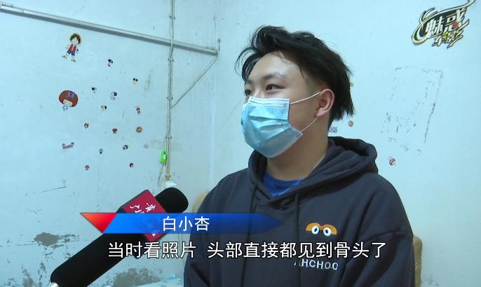 头部见骨 指关节缺失 3月龄女婴在家被不明动物啃伤 媒体 澎湃新闻 The Paper