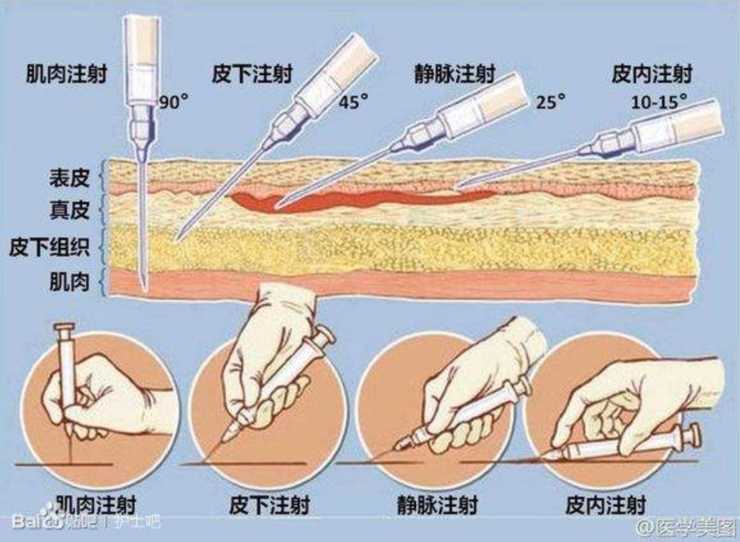 问题来了 为什么疫苗都不打在屁股上 湃客 澎湃新闻 The Paper