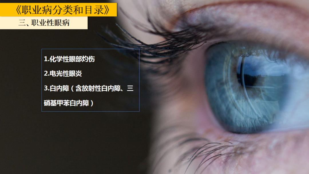 2020年职业病防治法宣传周法定职业病你了解多少