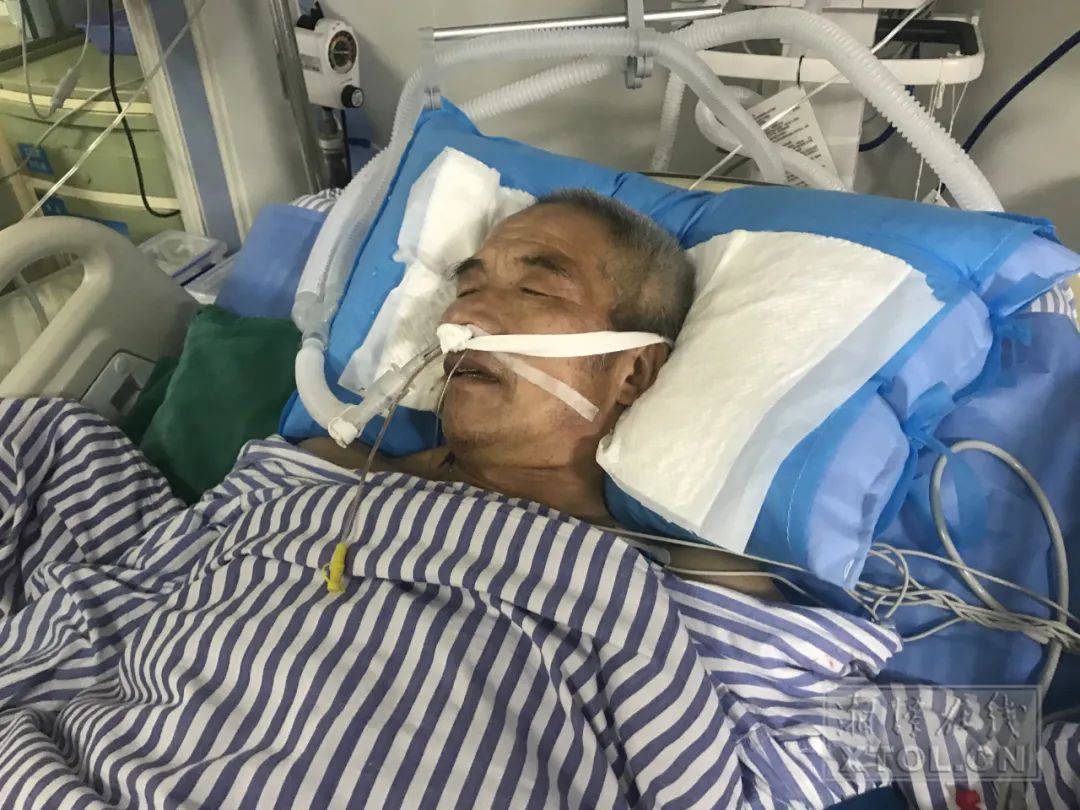 4月29日 湘潭市中心医院重症监护室11号病床上 一位老人在浅度昏迷的