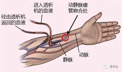 肾脉在手腕的位置图片图片