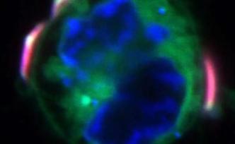 Science Advances：巨噬细胞的“背包”可杀死癌症