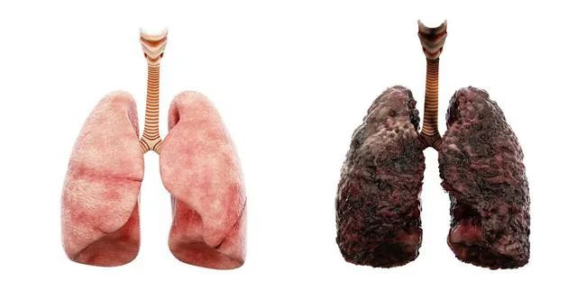 戒烟三年的肺图片图片