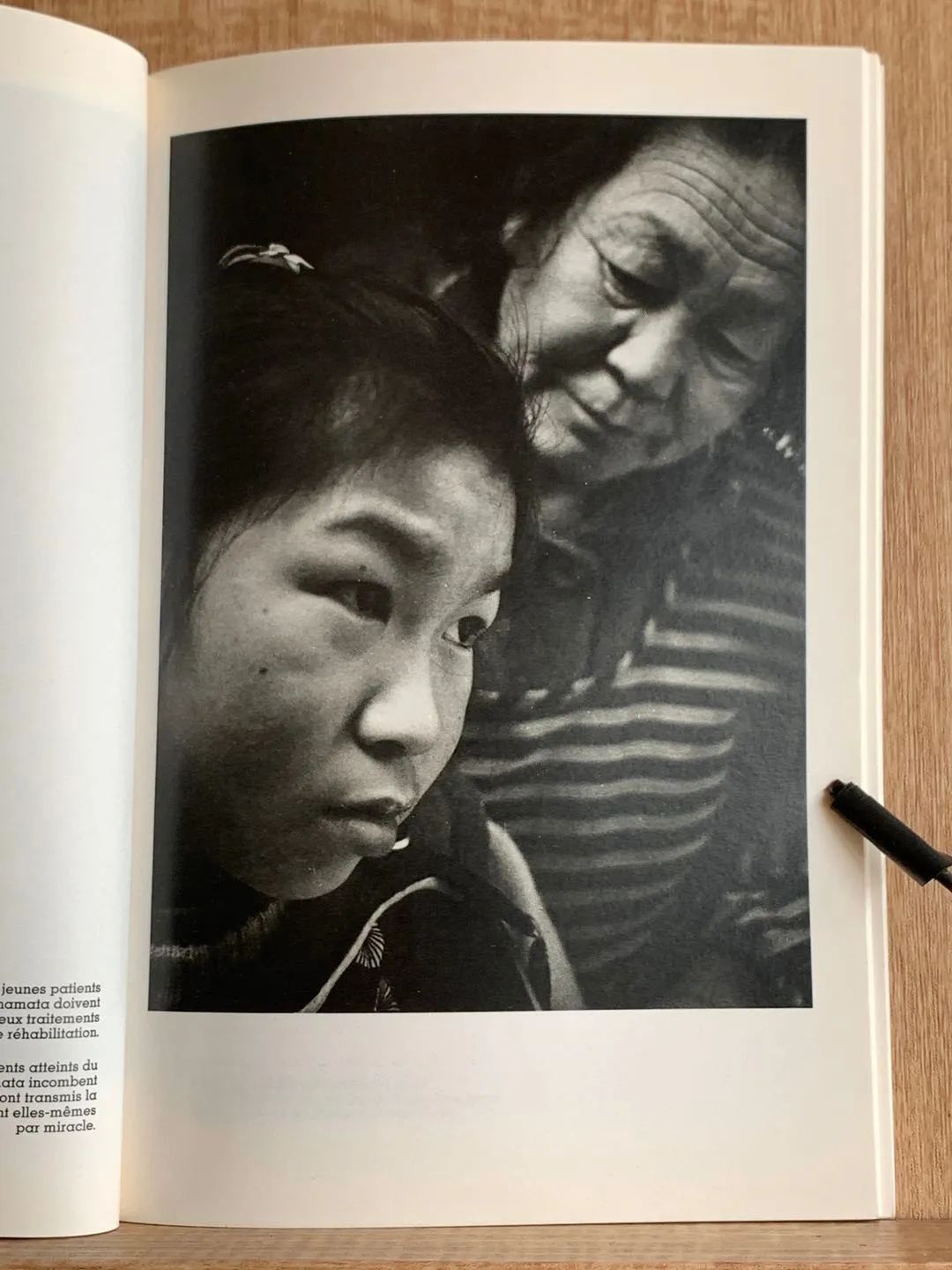 他用照片深度记录水俣病致命影响,为受害者呐喊