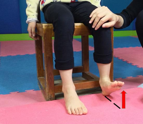 科普工作委员会脑瘫儿童膝过伸运动治疗