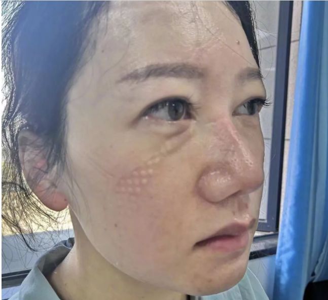 抗疫一线奋战多天后的刘丽.