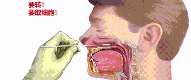 鼻咽拭子动图图片