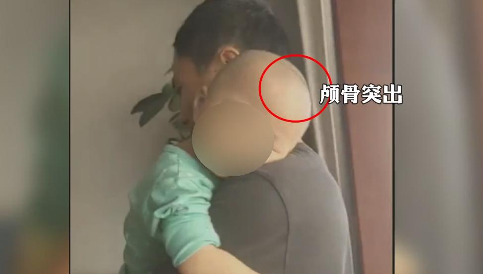 痛心大头娃娃事件为何又重演谁之过