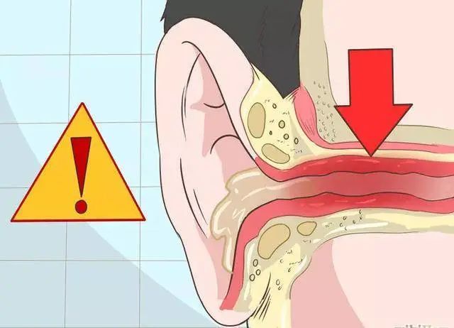 耳屎到底要不要挖 原来这么多年我们都做错了