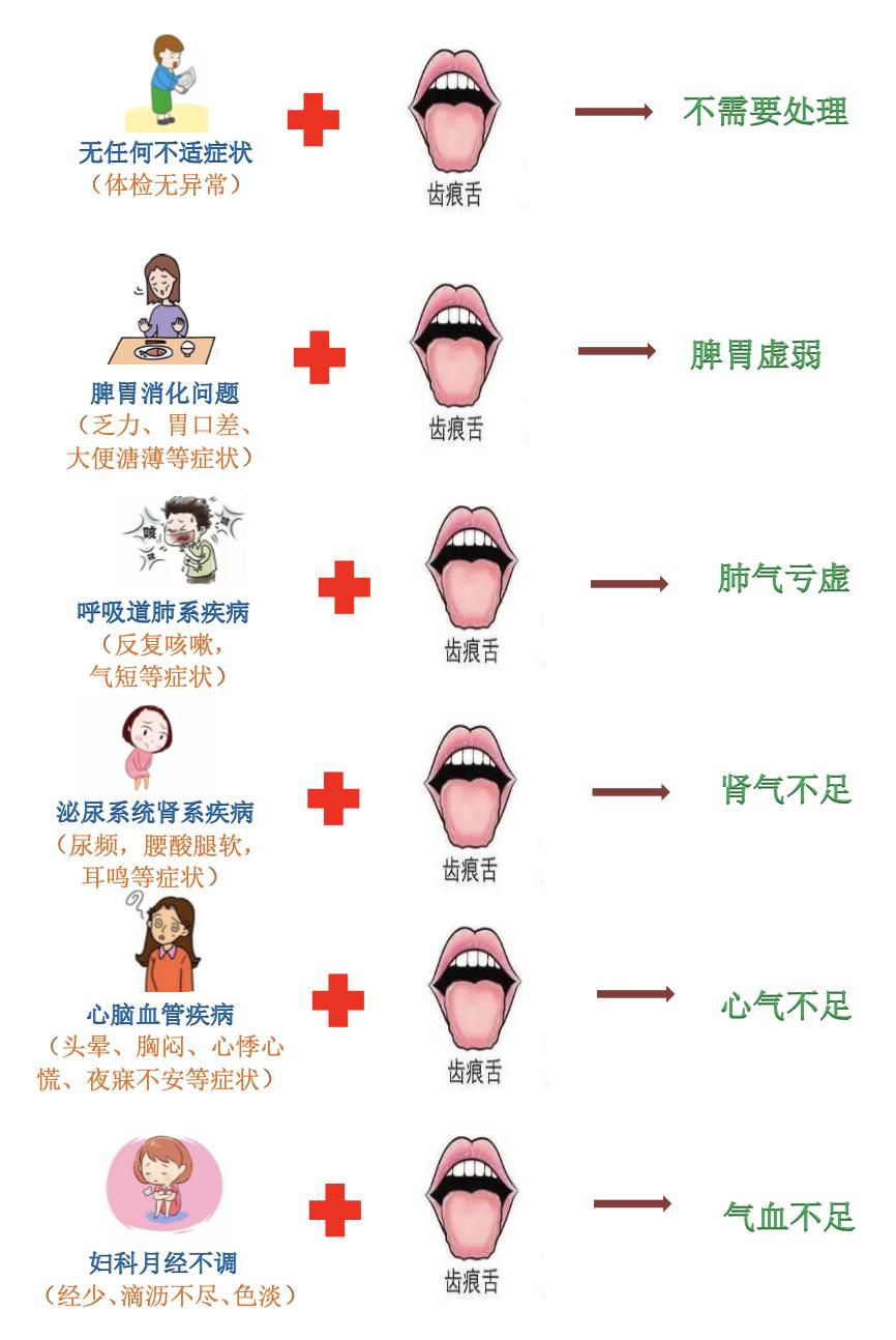 舌头锯齿状是什么原因图片